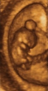 images/embriologi/baby.jpg