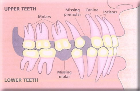 reasons teeth moving