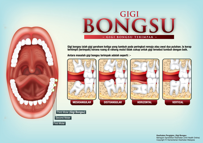 Gigi Bongsu Portal Myhealth