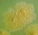 Kultur Mycobacterium tuberculosis pada media LJ berwarna kuning pucat2