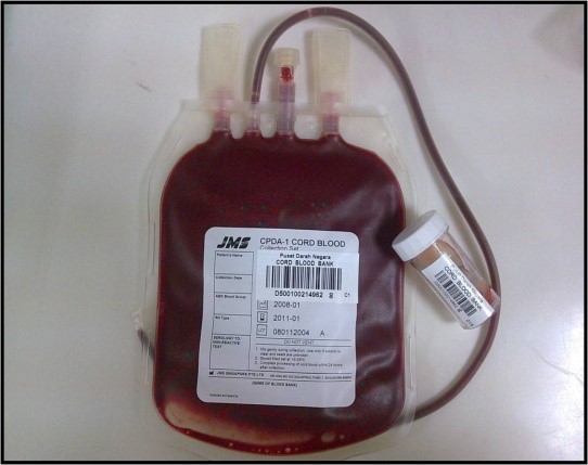 Pemprosesan dan Penyimpanan Darah Tali Pusat2