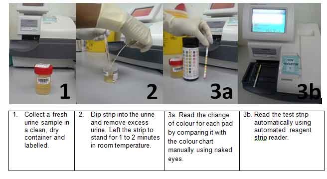 Test urine feme Urine Analysis