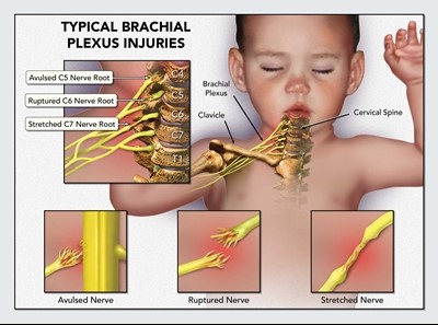 Brachial veins - Wikipedia