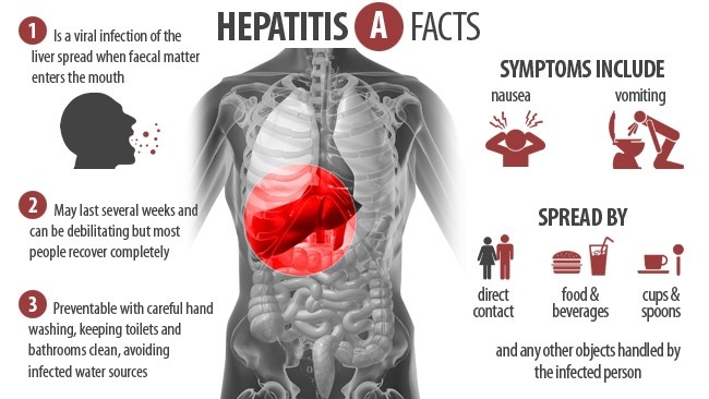 hepatitis A