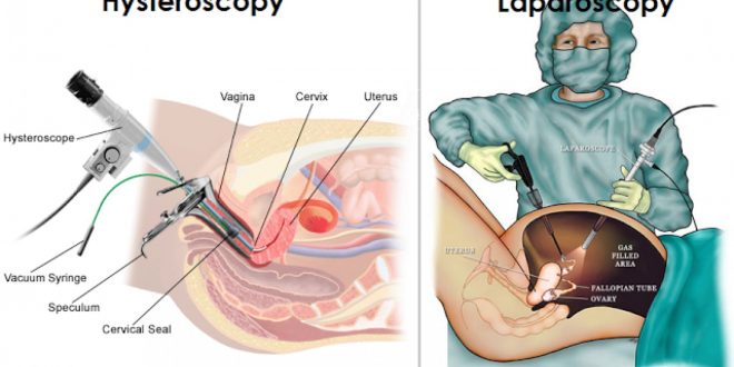 laparoscopy and hysteroscopy 1