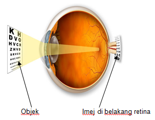 imej di belakang retina