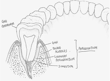 Dengan periodontium apakah yang dimaksudkan penyakit Penyakit OCD