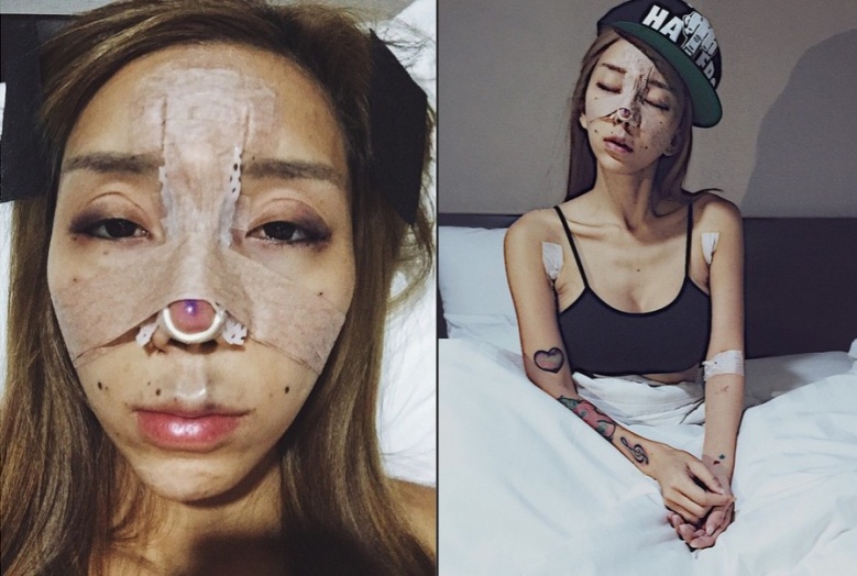 Malaysian DJ-model makes news with her plastic surgery photos.