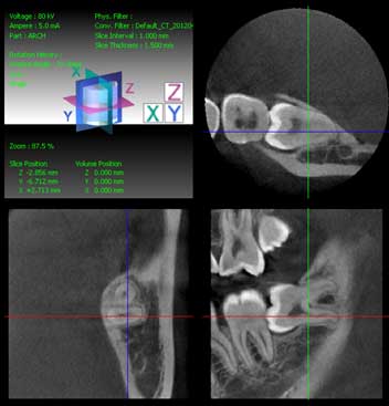 Selection Criteria In Dental Radiography